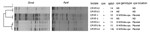 Thumbnail of Pulsed-field gel electrophoresis analysis and determination of the cpe genotype of Clostridium perfringens isolates obtained from a healthy person. ND, not determined.
