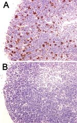 Thumbnail of Decreased apoptosis caused by overexpression of Bcl-2 protein in a mouse model of plague. Wild-type mice (A) and mice that overexpressed Bcl-2 in lymphocytes (B) were injected intranasally with Yersinia pestis. Thymuses were obtained at 72 h postinfection and stained by using the terminal deoxynucleotidyl method as a marker of apoptotic cell death. Note the decrease in apoptotic cells in the thymus of the Bcl-2 transgenic mouse (magnification ×400).