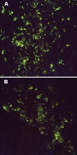 Thumbnail of Intracytoplasmic virus-specific fluorescence in brain tissues of an 11-day-old Mongolian gerbil (A) and a 10-day-old NIH Swiss mouse (B) injected intracerebrally with 6,000 PFU of Thottapalayam virus (TPMV) strain VRC-66412 from serum of an adult rat injected intramuscularly with TPMV (original magnification, x400).