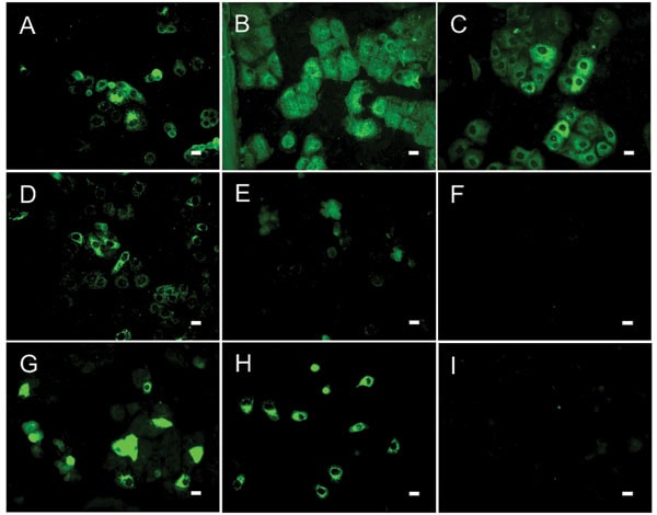 Results of indirect immunofluorescence (IF) test with Vero E6 cells infected with severe acute respiratory syndrome–associated coronavirus (SARS-CoV). The SARS-CoV diagnostic IIFT kit (EUROIMMUN AG, Lübeck, Germany) was used with minor modifications: bat and reference human serum specimens were diluted 1:100 (found to be the optimal dilution for bat sera) in sample buffer, and secondary detection was performed with goat-antibat immunoglobulin (Ig) (Bethyl, Montgomery, AL, USA) followed by fluorescein isothiocyanate (FITC)–labeled donkey-antigoat Ig (Dianova, Hamburg, Germany) (A–F) or FITC-labeled goat-antihuman Ig (G–I). Frames A–D, SARS-CoV ELISA–positive bat serum specimens 2, 17, 26, 31; E–F, ELISA-negative bat serum specimens 38 (showing unspecific signals) and 306; G–H, SARS-CoV–positive human control serum specimens A and B; I, negative human serum C. All photographs were taken at equivalent microscope settings. Scale bars represent 20 μm.