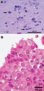 Thumbnail of Photomicrographs showing A) encephalitis with neuronal necrosis and intranuclear inclusions (arrows) in a polar bear (Ursus maritimus); scale bar = 50 μm; hematoxylin and eosin stain; and B) Grevy’s zebra (Equus grevysi) with acute rhinitis with eosinophilic inclusions in respiratory epithelium; scale bar = 20 μm; hematoxylin and eosin stain.