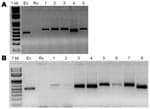 Thumbnail of Agarose gel electrophoresis of PCR products amplified with Ehrlichia chaffeensis (Ec) variable-length PCR target primers. Rc, Rickettsia conorii (negative control). The sources of DNA templates used for amplification are Amblyomma parvum ticks collected from different hosts: A) 1–5 humans; B) 1 dog, 2 foxes, 3–6 cattle, 7–8 goats. Variable amplicon size represents different genotypes that result from differences in the number of tandem repeats in the 5′ end of the variable-length PCR target; PCR products’ sizes range from 500 bp to 600 bp.