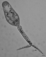Thumbnail of Live schistosome cercaria from a Haminoea japonica snail. Scale bar = 30 µm. Measurements are shown in Table 2.