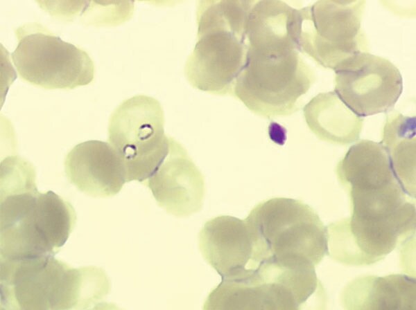 Two trophozoites of Babesia spp. in 1 erythrocyte from case-patient 2 (original magnification ×1,000, May-Grünwald-Giemsa stain).