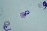 Thumbnail of Viable Baylisacaris procyonis larvae demonstrating intact membrane and impermeability to methylene blue. Original magnification ×40.