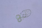 Thumbnail of Hatched nonviable Baylisascaris procyonis larvae demonstrating uptake of methylene blue. Original magnification ×40.