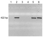 Thumbnail of PCR amplification of Granulicatella adiacens DNA. DNA was prepared from the bacteria indicated, PCR-amplified with G. adiacens–specific primers, and subjected to agarose gel electrophoresis with ethidium bromide staining and ultraviolet light visualization. Lane 1, water, negative control; lane 2, G. adiacens–positive control, ATCC 49175; lane 3, DH5α Escherichia coli–negative control (Invitrogen, Carlsbad, CA, USA) 18263–012; lane 4, Enterobacter sakazakii–negative control, ATCC BA