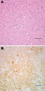 Thumbnail of Histopathologic analysis of transgenic mouse expressing bovine prion protein (PrP) gene inoculated with bovine spongiform encephalopathy agent. Spongiform degeneration in the thalamus (A), adjacent section showing PrP immunopositivity (B). Panel A was stained with hematoxylin and eosin, panel B was immunostained with PrP antibody 6D11. Scale bars = 100 μm.