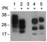 Thumbnail of Western blot of brain extract from C57/Bl mouse inoculated with 22L mouse-adapted scrapie agent (lanes 1, 2); NIH-3T3 cells exposed to normal mouse brain and passaged 30 times (lane 3); NIH-3T3 (lane 4) and L929 (lane 5) cells exposed to 22L scrapie agent and passaged 30 times. Nonproteinase K [PK]–treated samples (lane 1), PK-treated samples (lanes 2–5). Western blots were probed with prion protein monoclonal antibody 6H4.