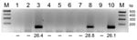Thumbnail of RNA extracted from pools of Culicoides obsoletus group midges was tested in 1-step reverse transcription quantitative PCRs (RT-qPCRs) for the Schmallenberg virus L segment, and the products were analyzed by agarose gel electrophoresis. Lanes 1–8, C. obsoletus group midge pools 1–8; lanes 9–10; negative and positive controls, respectively. Numbers below lanes are cycle threshold values from RT-qPCRs; –, no value. M, size marker. Amplicons (145 bp) from positive pools were extracted a
