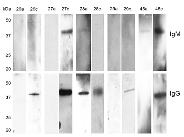 Western blot reactivity to recombinant Borrelia miyamotoi glycerophosphodiester phosphodiesterase in serum samples from 5 Borrelia miyamotoi sensu lato–seropositive patients in the northeastern United States, 1991–2012. Numbers at the top of rows are patient numbers and correspond to patients 26–29 and 45 in (Table 1). The letters a and c that follow patient numbers indicate acute- and convalescent-phase serum samples, respectively. Western blot results that show no seroreactive IgG and/or