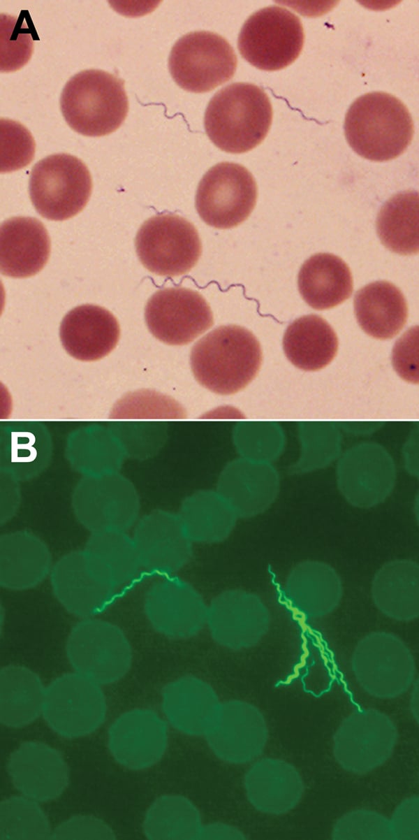 A) Spirochetes in blood smear of a 55-year-old man with tickborne relapsing fever, Bitterroot Valley, Montana, USA (Giemsa stain). Erythrocyte diameters are ≈6–8 µm. B) Spirochetes in blood smear of the patient visualized by indirect immunofluorescent antibody staining with mouse monoclonal antibody H9724 and goat anti-mouse antibody conjugated with fluorescein isothiocyanate (original magnification ×1,000).