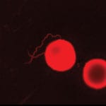 Thumbnail of Borrelia miyamotoi in cerebrospinal fluid stained by acridine orange (LSM Exciter 5, Zeiss, Germany). The cerebrospinal fluid was from a 74-year-old woman with non-Hodgkin lymphoma. Original magnification ×1,000.