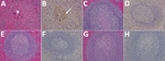Thumbnail of Results of testing for Nipah virus (NiV) in spleen tissue from representative vaccinated African green monkeys (Chlorocebus aethiops). A, C, E, G) Hematoxylin and eosin staining; B, D, F, H) immunohistochemistry of tissues labeled with NiV N protein–specific polyclonal rabbit antibody. In stained tissue from the control animal (A), moderate necrosis and drop of out the white pulp (*), with hemorrhage, and fibrin within germinal centers are seen; stained sections examined from the Ni