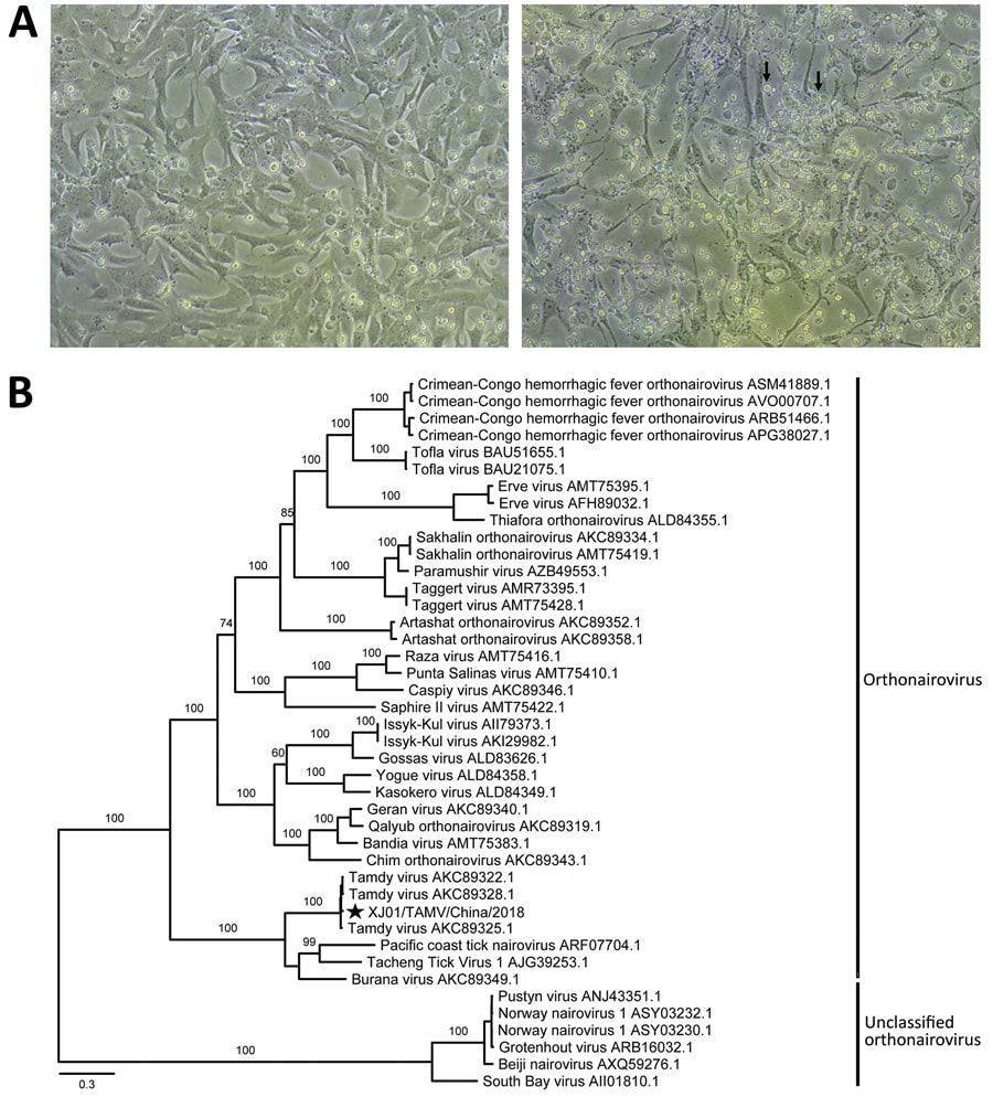 Identification of the Tamdy virus (TAMV) strain XJ01/TAMV/China/2018 from Hyalomma asiaticum ticks infesting Bactrian camels in Xinjiang, China, 2018, by cell culture and phylogenetic analysis. A) Light micrographs of cytopathic effects caused by TAMV infection at 11 days postinfection. Left, normal Vero cells as control; right, infected Vero cells with apparent cytopathic effects (black arrows). Original magnification ×100. B) Phylogenetic analysis of the RNA-dependent RNA polymerase protein se