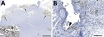 Detection of influenza virus antigen by immunohistochemistry in brain (A) and lung (B) of harbor seals (Phoca vitulina) infected by highly pathogenic avian influenza A(H5N1) virus, St. Lawrence Estuary, Quebec, Canada, 2022. A) Brain tissue. Multifocal areas of intense immunostaining (arrows) with staining of all structures are seen in the affected area, including neurons and neuropil (inset). Scale bar indicates 2 mm. B) Lung tissue. Positive immunostaining can be observed within alveolar septae (arrow) and in bronchiolar epithelial cells (arrowhead). Scale bar indicates 80 µm.