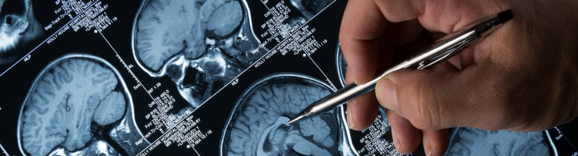Doctor Examining Brain Images, Only Pen in Shown