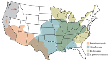 Map of Fungal Diseases in the United States