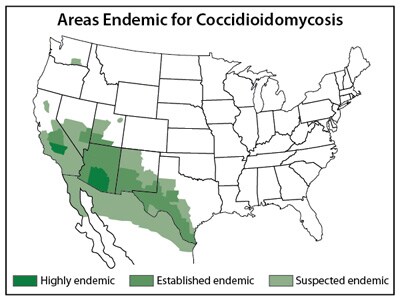 Areas where Valley fever lives in the US