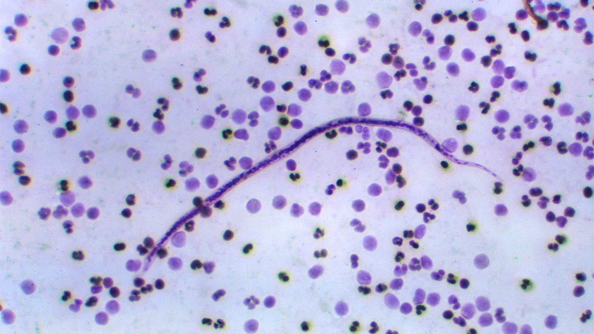 Single filarial nematode known as Loa loa.