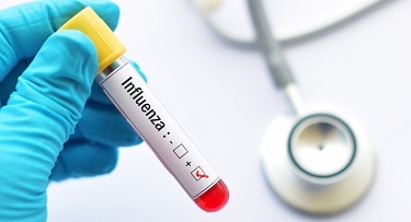 Classifying Flu Severity