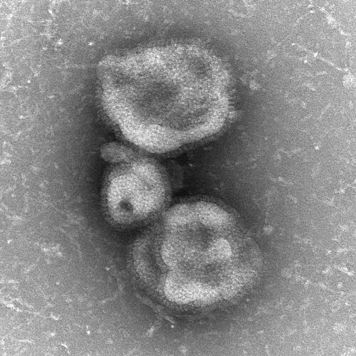 Electron Micrograph Images of H7N9 Virus from China