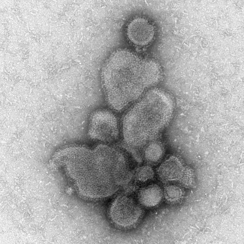 Imágenes de micrografía de electrones del virus H7N9 de China