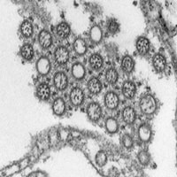 Imagen de un virus de la influenza.