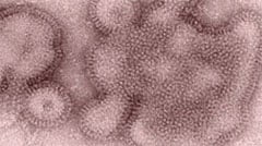 Swine flu virus strain under microscope