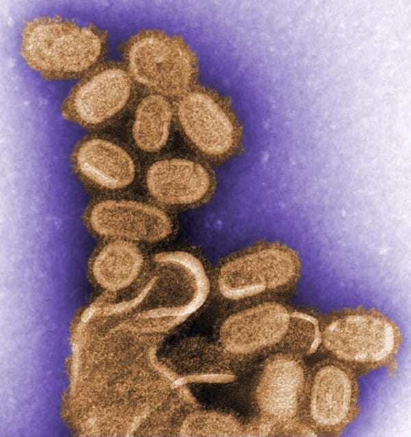 A colorized image of the 1918 virus taken by a transmission electron microscope (TEM). The 1918 virus caused the deadliest flu pandemic in recorded human history, claiming the lives of an estimated 50 million people worldwide. Photo credit:  C. Goldsmith - Public Health Image Library #11098.