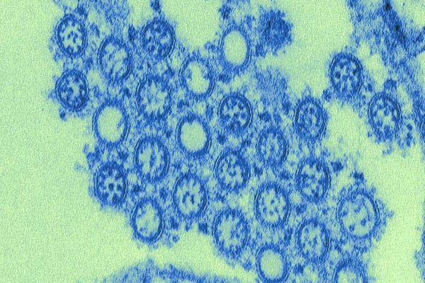 image of h1n1 virus