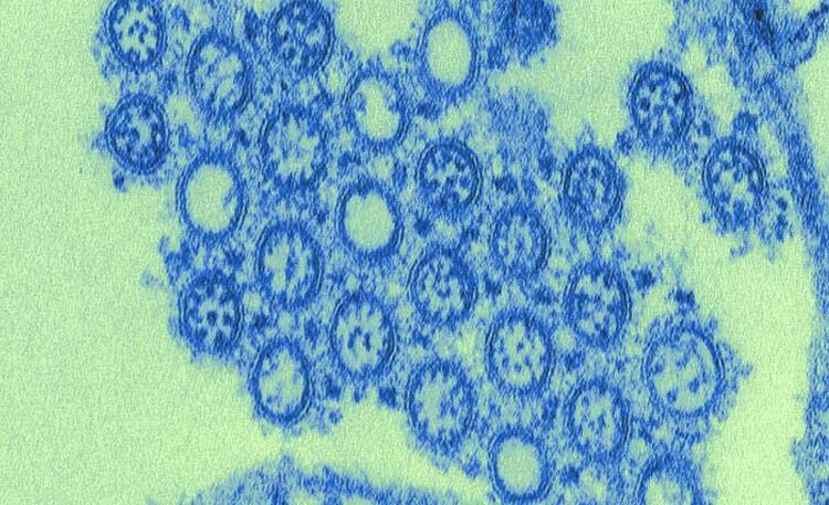 image of the virus responsible for the 2009 pandemic