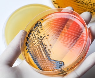 hand holding a petri dish with culture