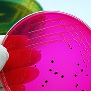 pink culture in a petri dish