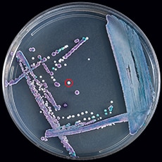 . Mixed culture of Candida glabrata (purple), Candida tropicalis (navy blue), and Candida auris (white, circled in red) on CHROMagar Candida. 