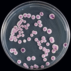 Candida auris on CHROMagar Candida, displaying multiple color morphs
