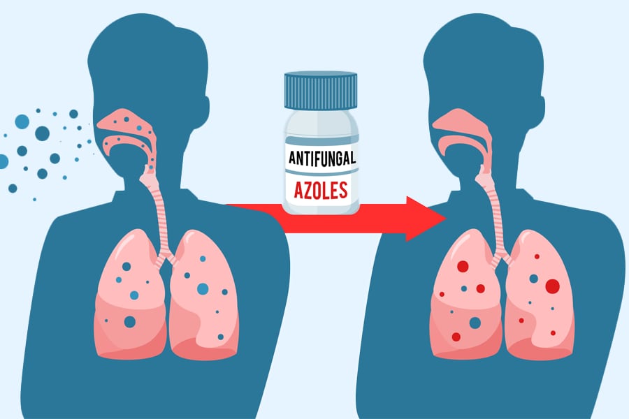 Lungs before and after treatment. Left is infected with blue dots and the right is treated having red and blue dots.