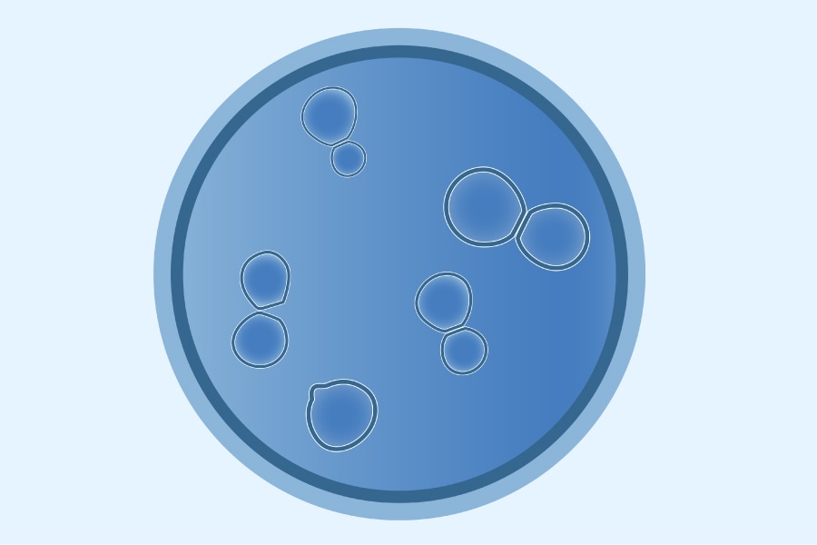 Image of Blastomycosis disease cell