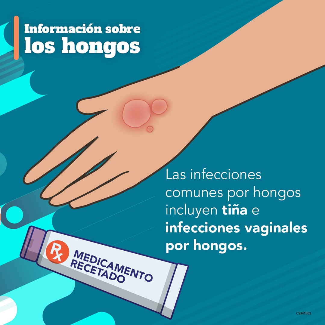 Información sobre los hongos: Las infecciones comunes por hongos inclyen tiña e infecciones vaginales por hongos.