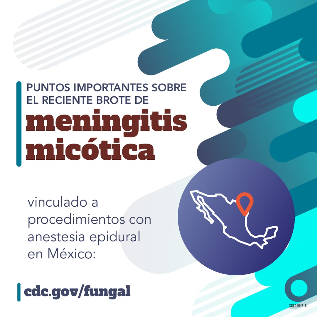 Puntos importantes sobre el reciente brote de meningitis micótica vinculado a procedimientos con anestesia epidural en México: cdc.gov/fungal