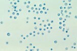  A photomicrograph of Cryptococcus
