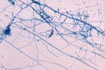  Photomicrograph of the dermatophyte Trichophyton mentagrophytes