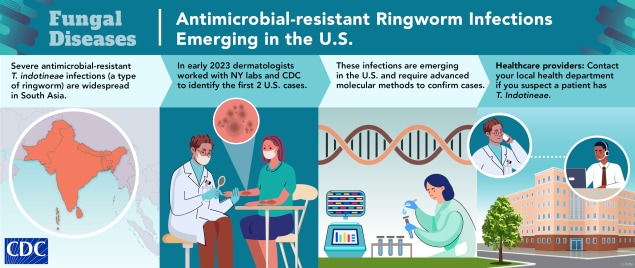 Antimicrobial-resistant ringworm infections are widespread in South Asia and have spread to the United States.