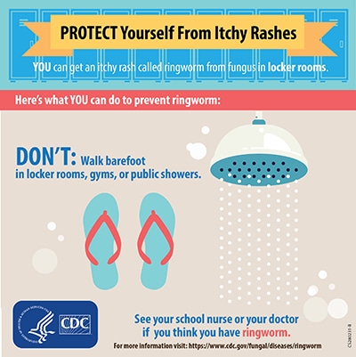 Protect yourself from itchy rashes: DON'T walk barefoot in locker rooms, gyms, or public showers