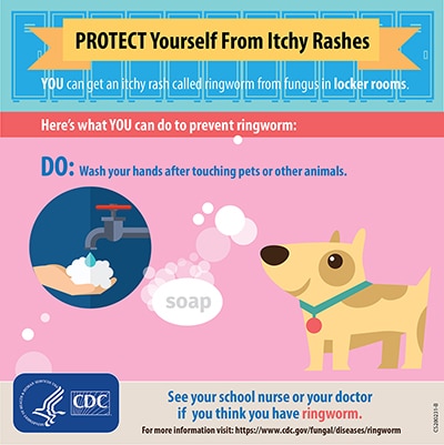 Protect yourself from itchy rashes: DO wash your hands after touching pets or other animals.