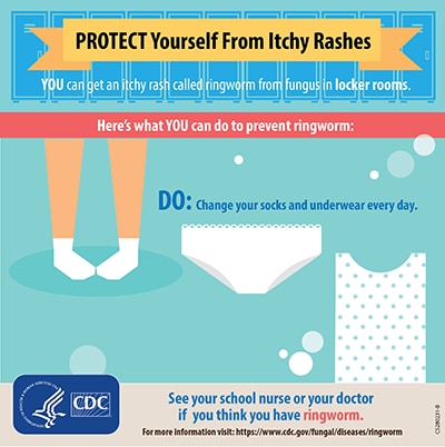 Protect yourself from itchy rashes: DO: change your socks and underwear every day.