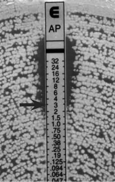 Figure 18. Candida spp., slim ellipse and microcolonies
