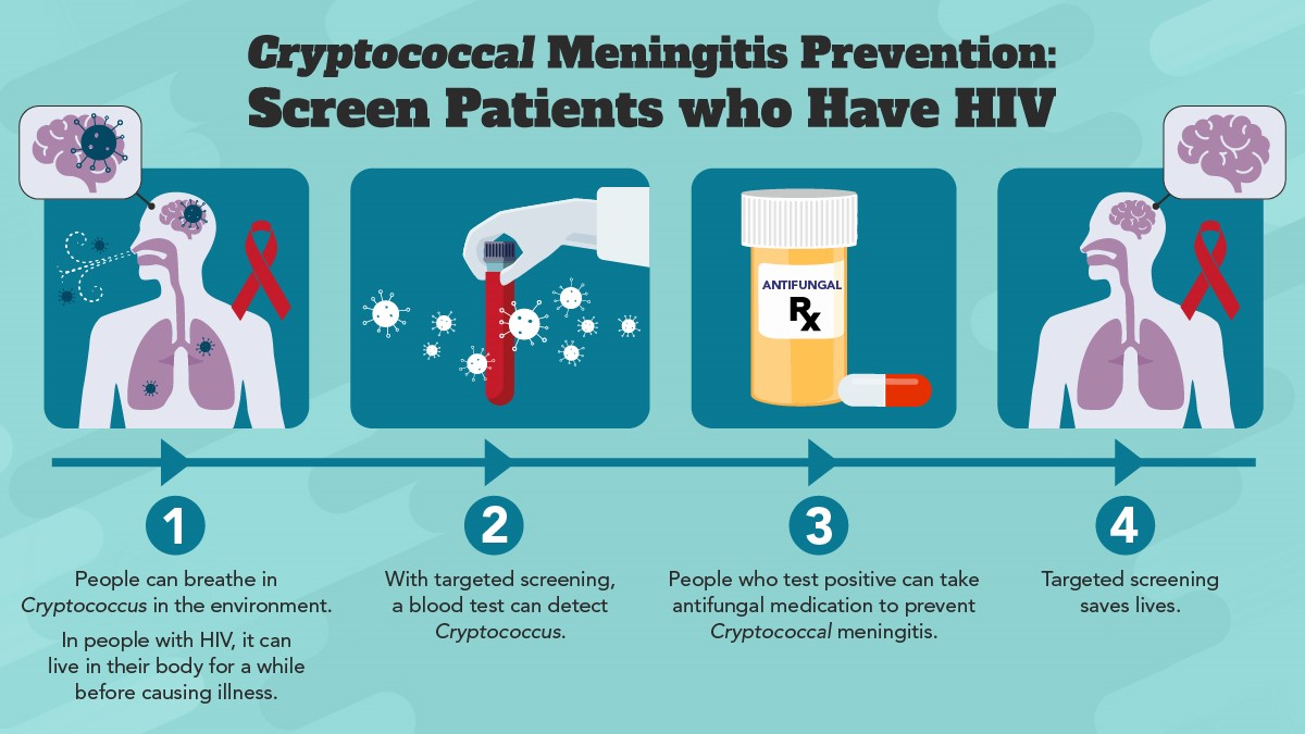 Four steps to screening patients with HIV for cryptococcal meningitis.