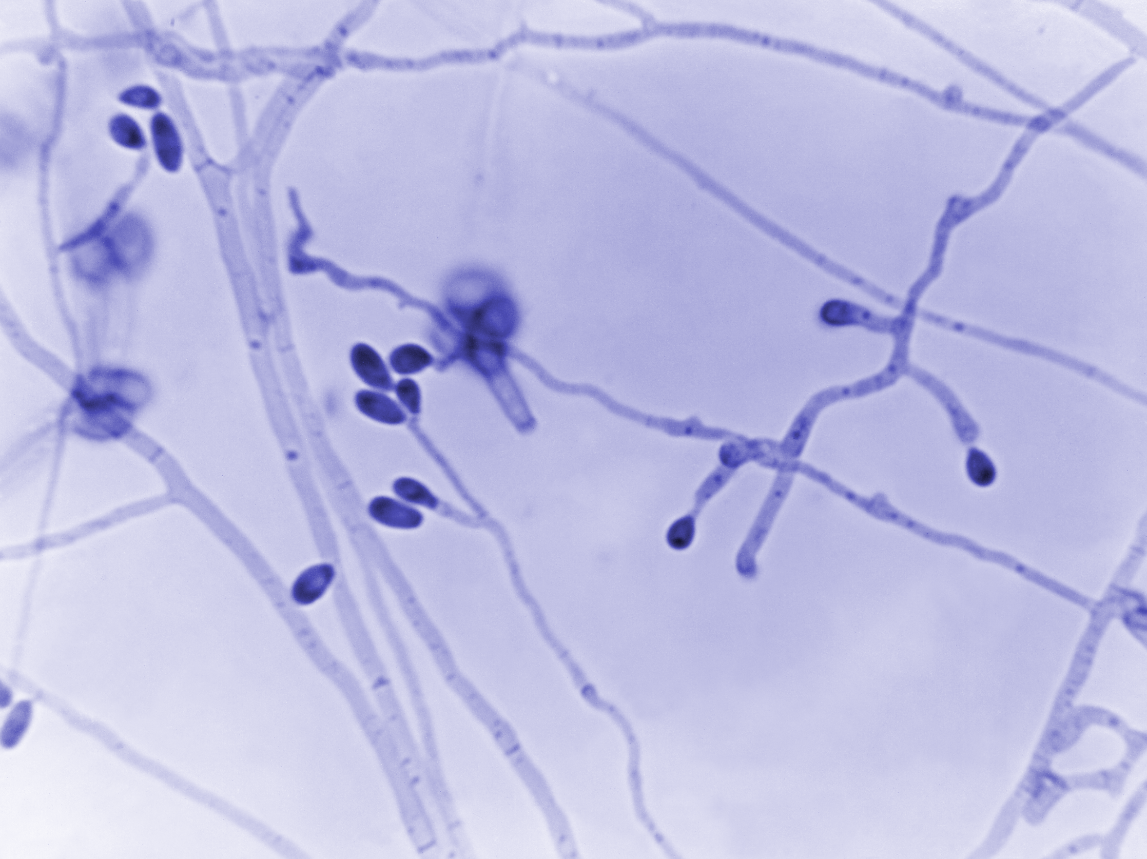 A zoomed in pictograph of mold.