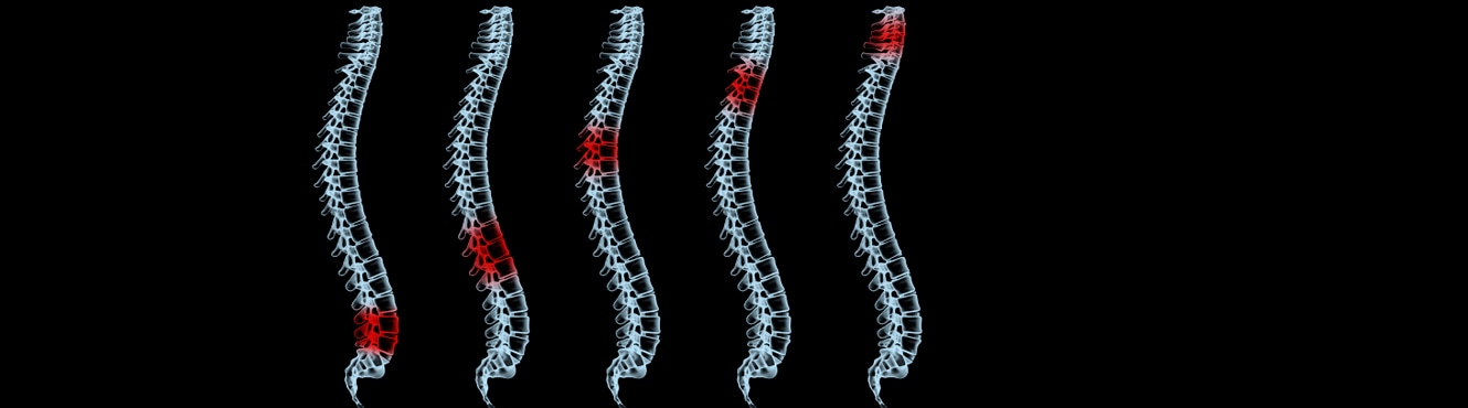 spines with different sections highlighted